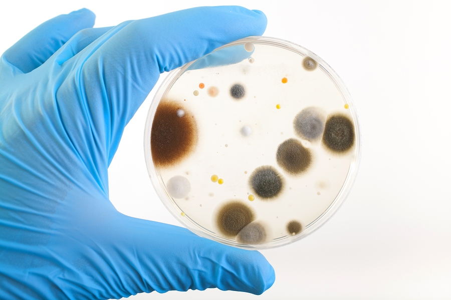 Hand Holding Petri Dish